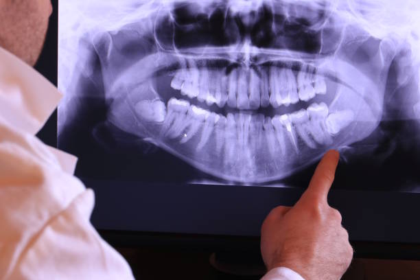 Best Emergency Dentist for Lost Fillings or Crowns in Pepper Pike, OH