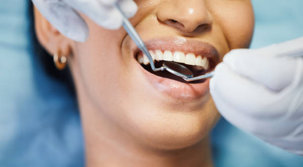 Best Emergency Dentist for Knocked-Out Tooth in Pepper Pike, OH